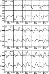 \begin{figure}
\par\includegraphics[width=8.9cm]{0448fig9.eps}\par\includegraphi...
...9cm]{0448fig10.eps}\par\includegraphics[width=8.9cm]{0448fig11.eps}
\end{figure}